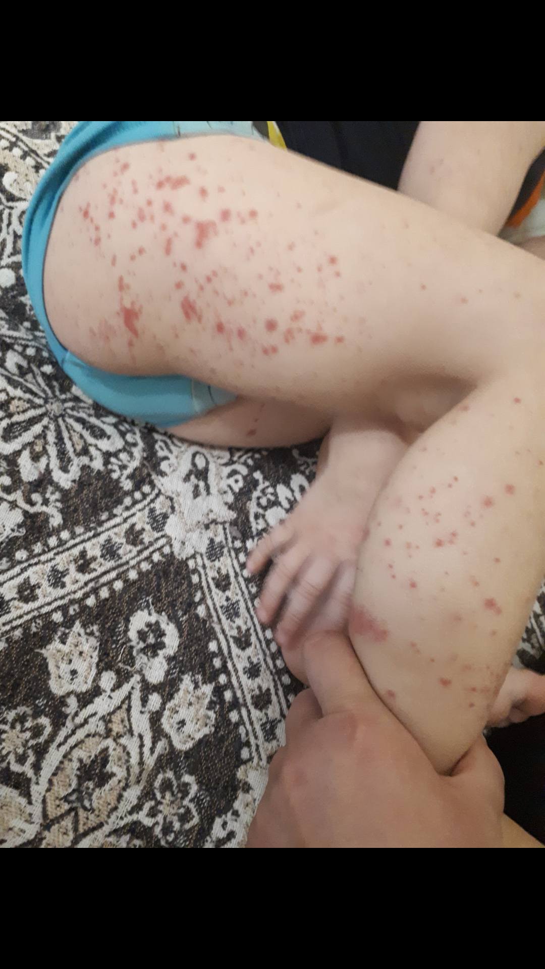 Нужны деньги на лекарства