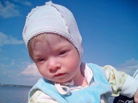 Сбор денег на лечение!!!