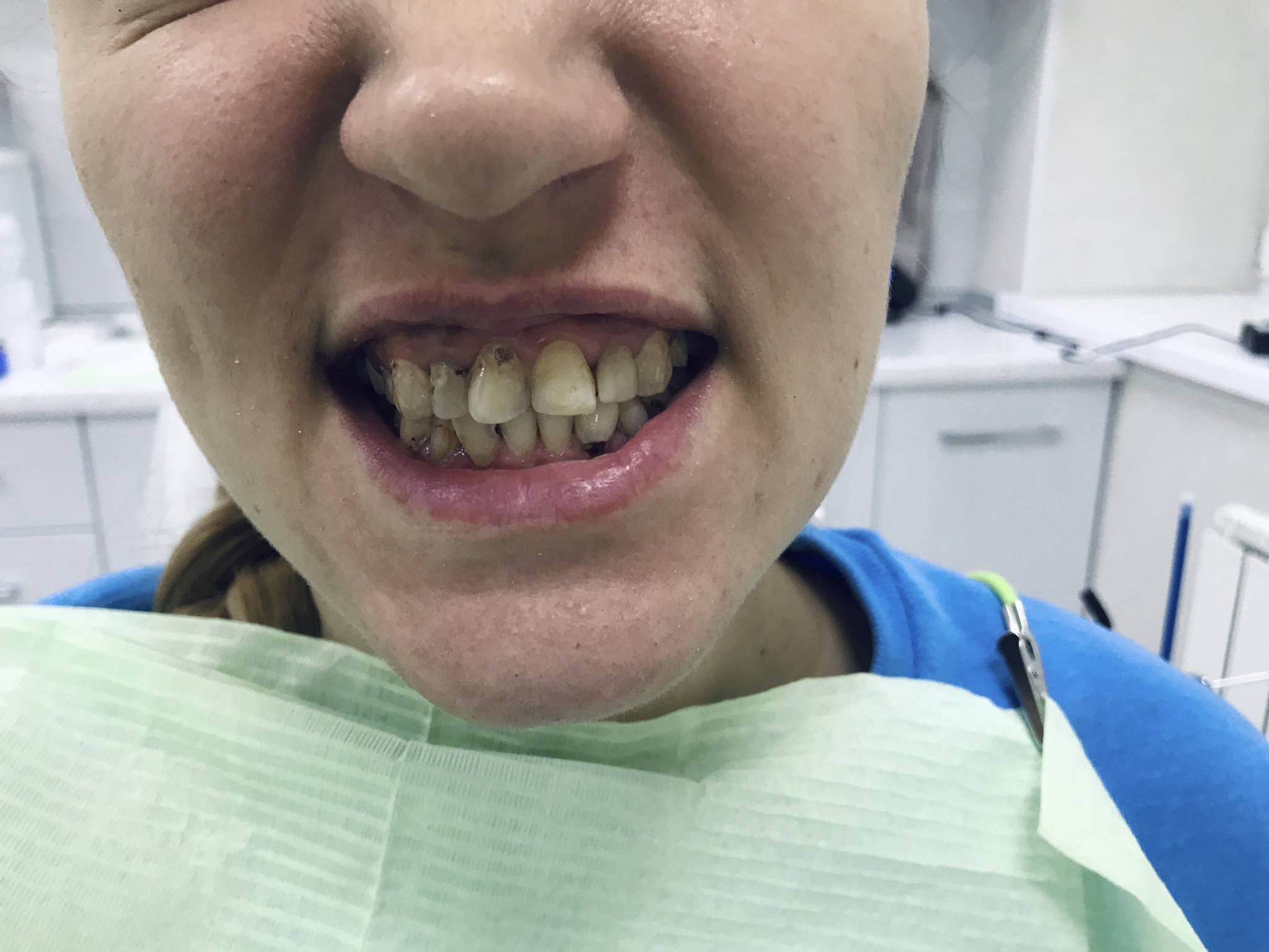 Здоровые зубы ?