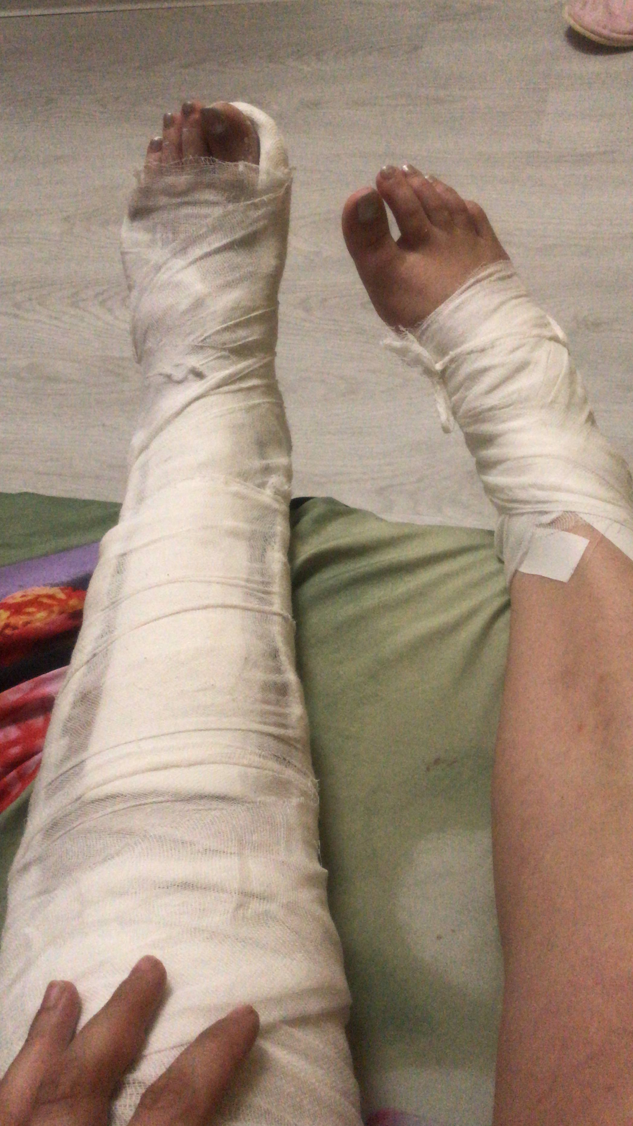 Оказалась в чужой стране и получила травму