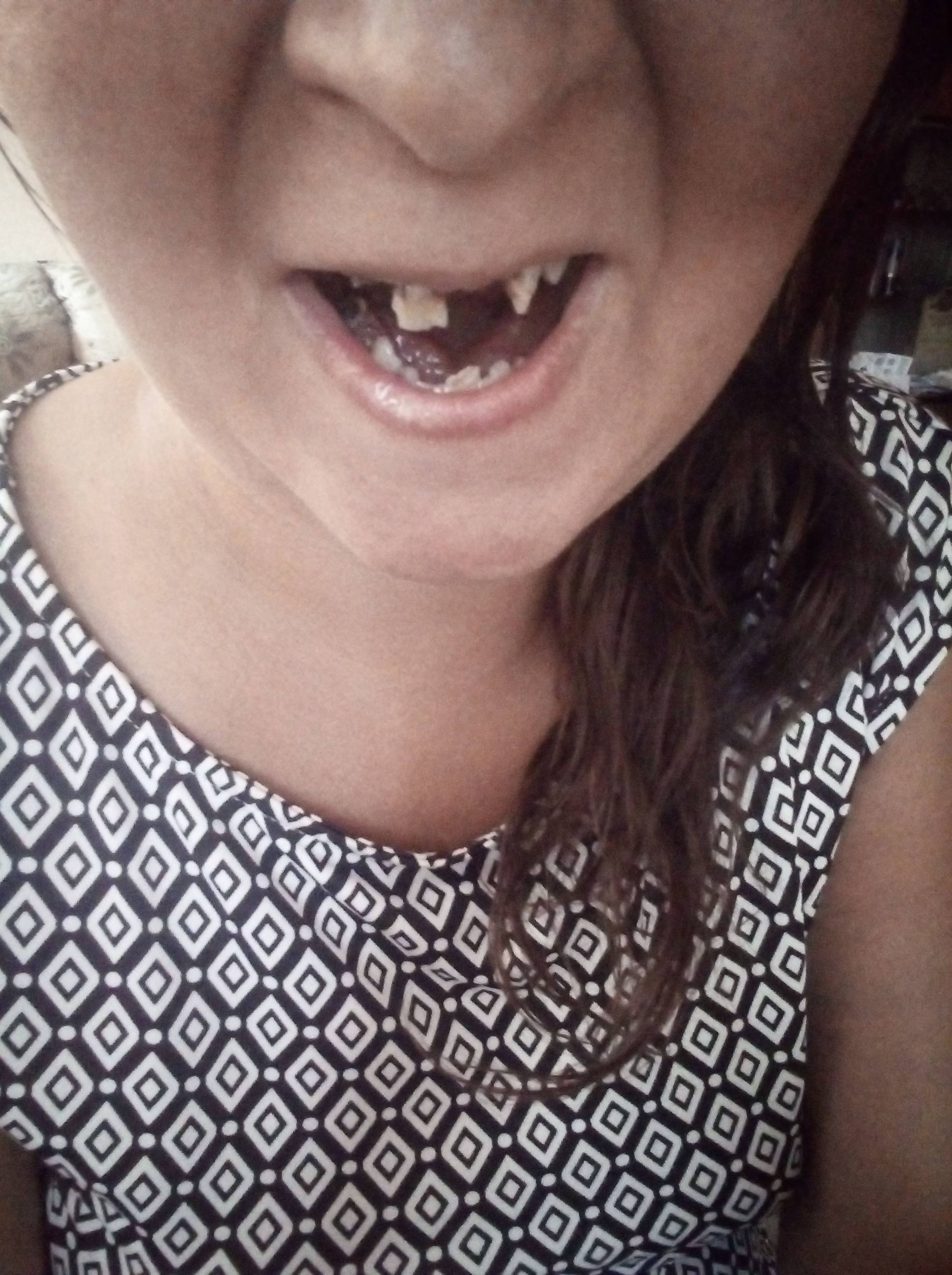 Помогите на лечение зубов