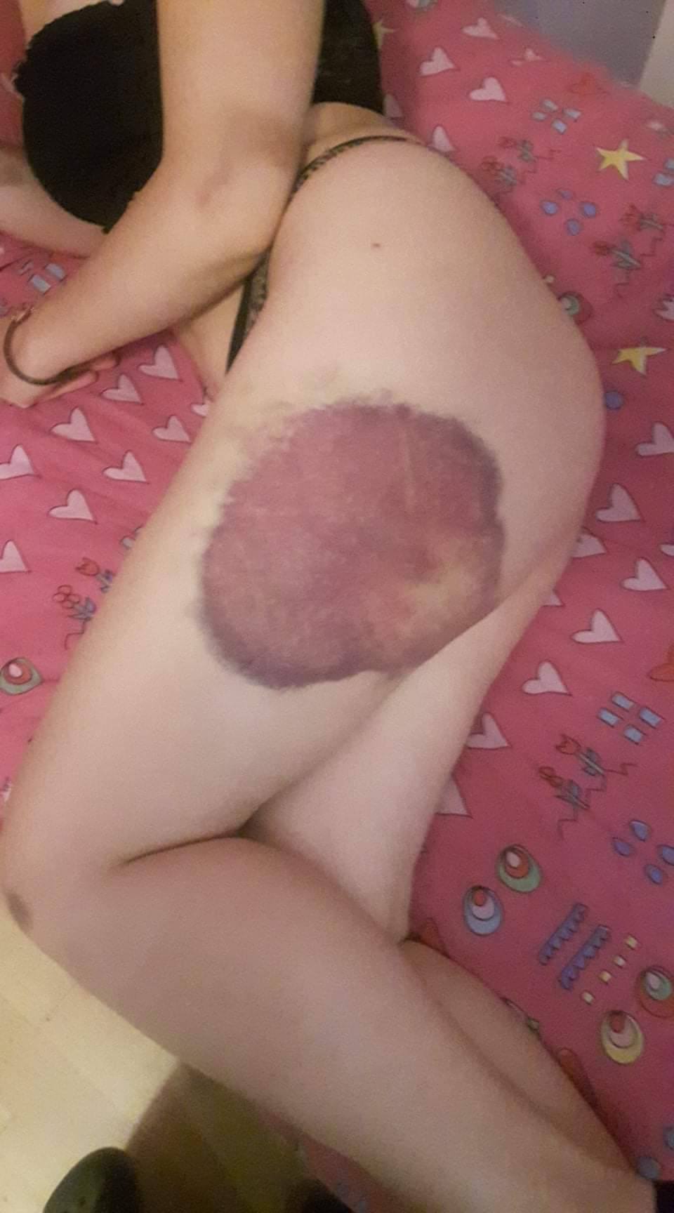 Травма на предприятии. +55р. Ольга Владимировна О.