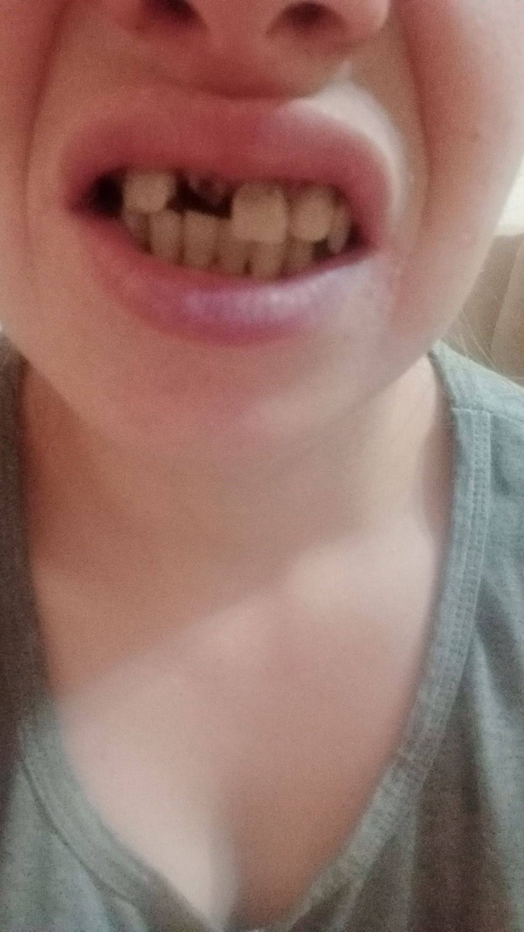 Помогите сделать зуб передний пожалуйста