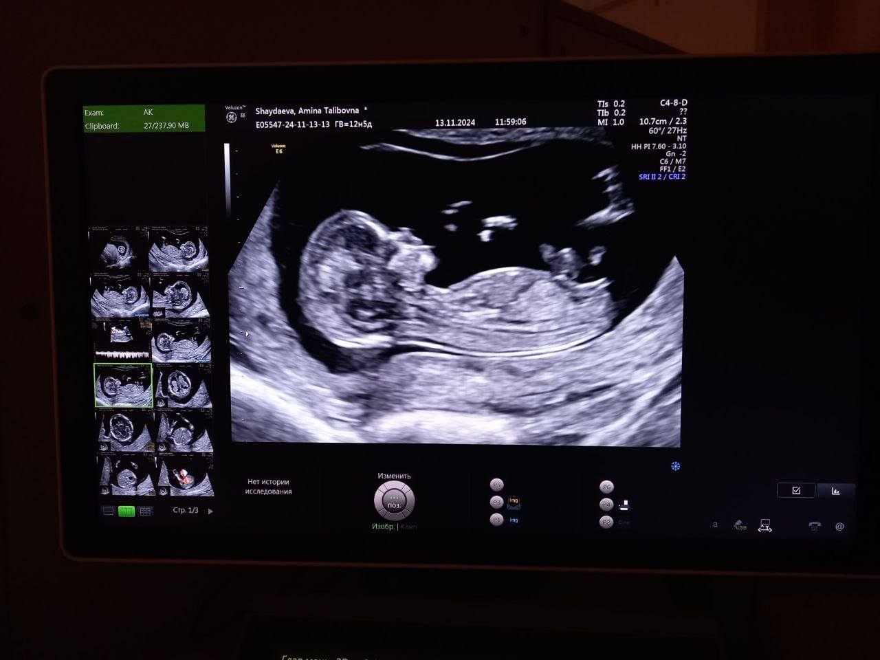 Мечтаю родить ребенка и избавиться от коедитов