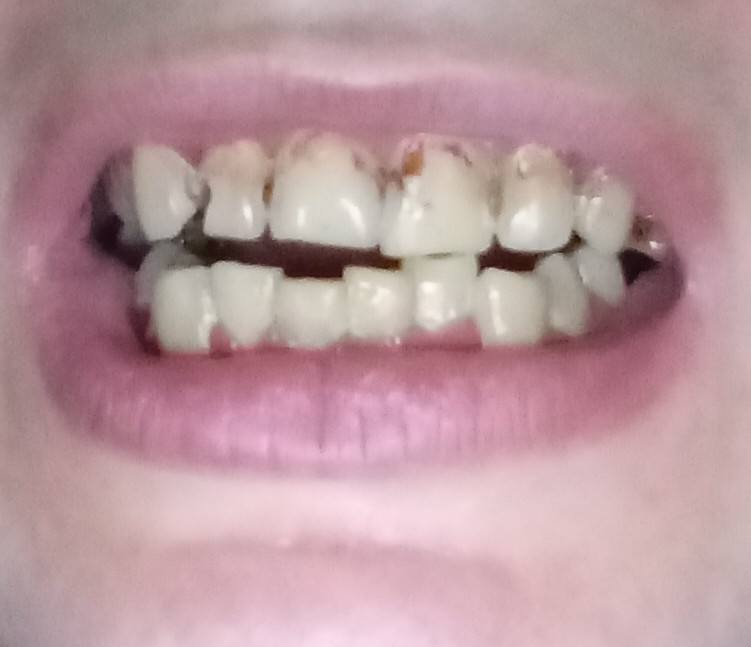 Мечтаю 🥺 просто вылечить зубы 🦷 и всё. 🙏🙏🙏🙏