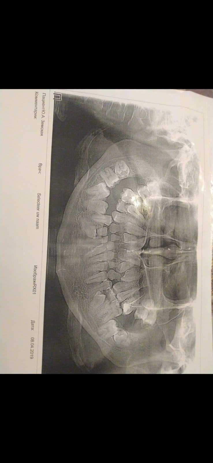 Лечение зубов.