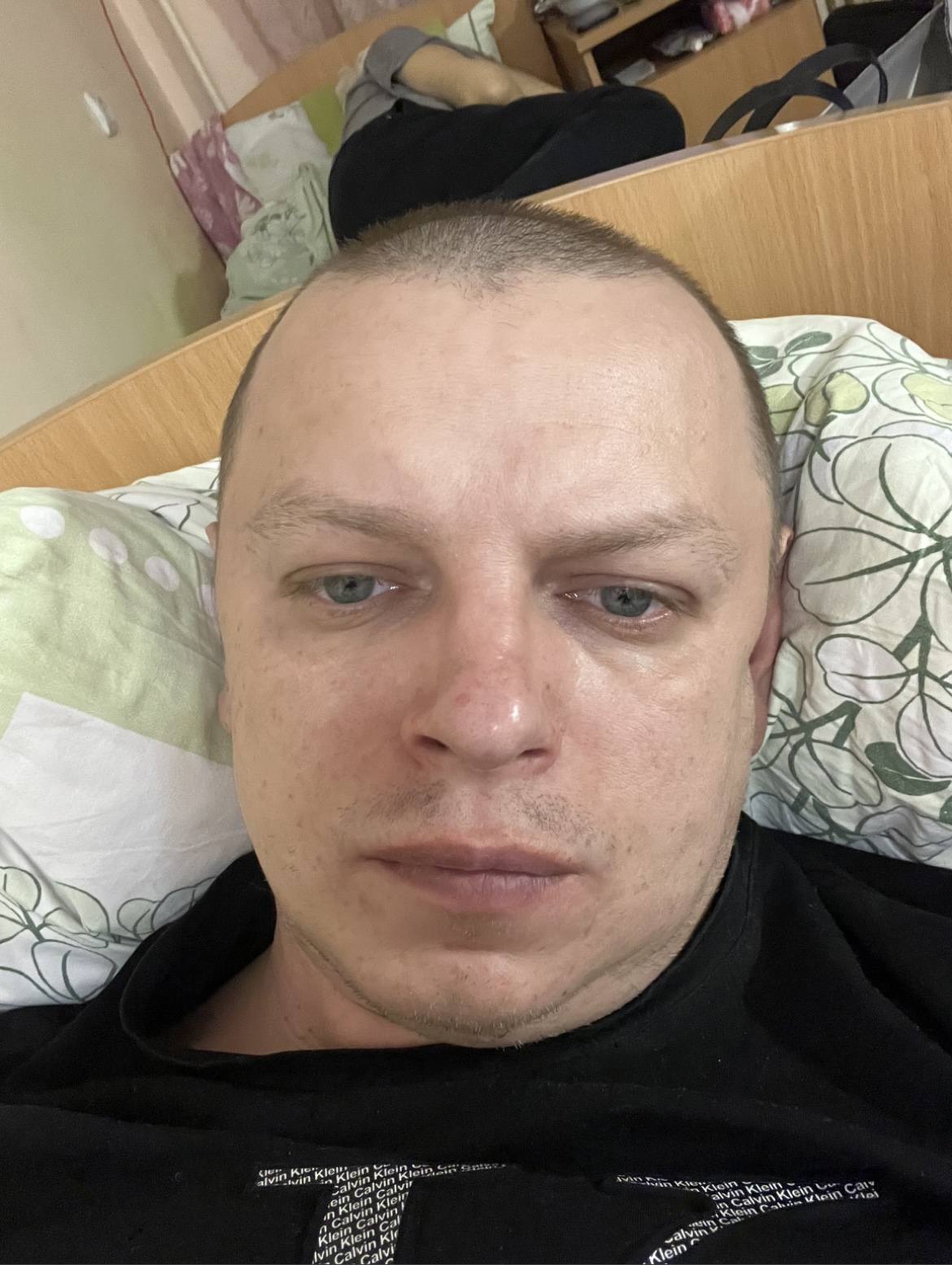 Онкология . Острый миелобластный лейкоз