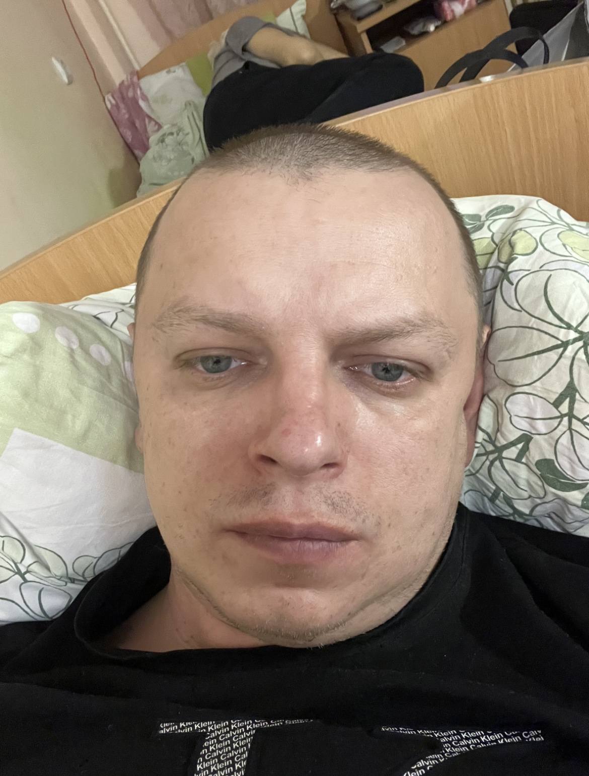 Онкология . Острый миелобластный лейкоз