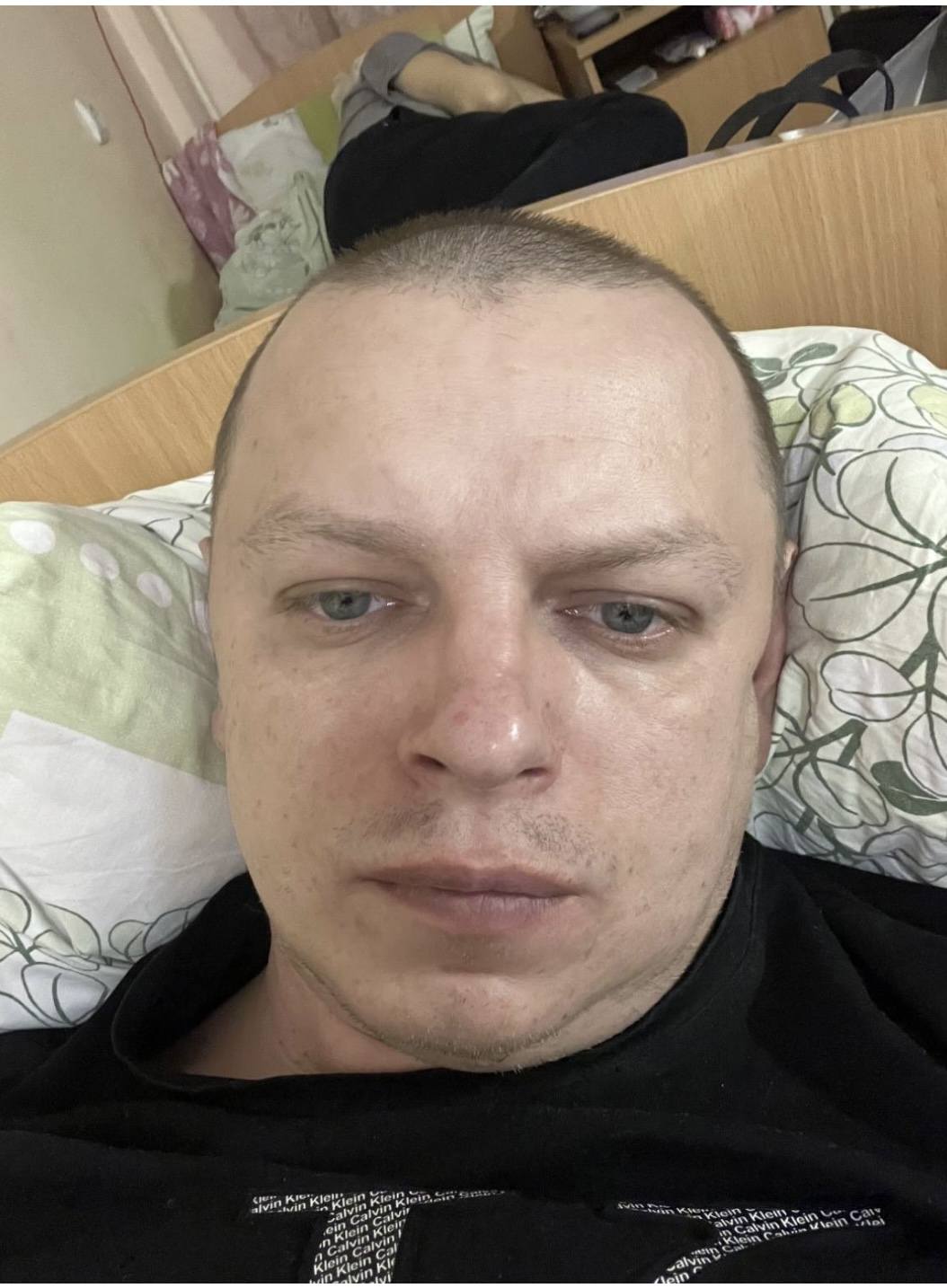 Онкология . Острый миелобластный лейкоз