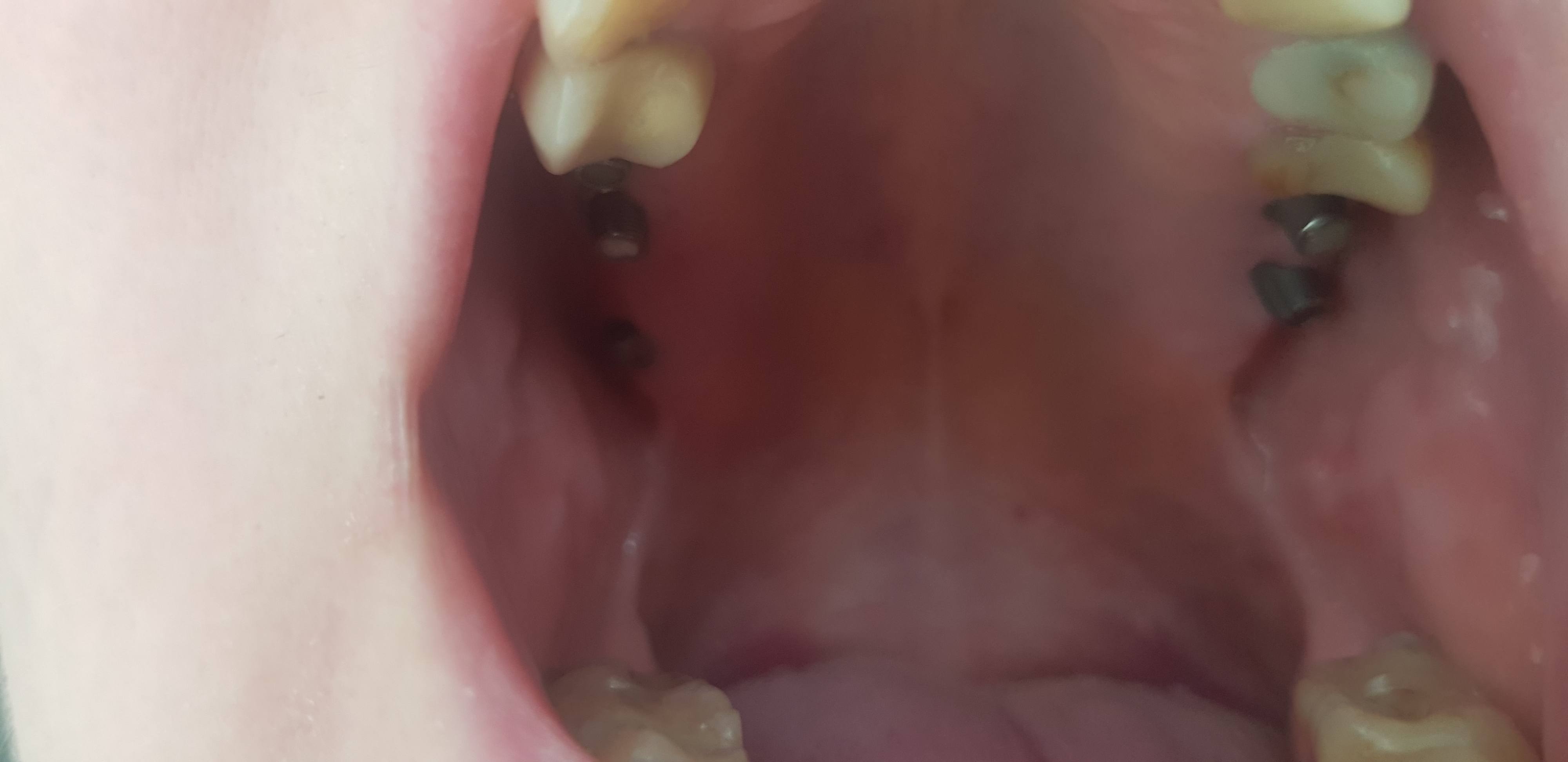 Мечтаю об здоровой и красивой улыбке