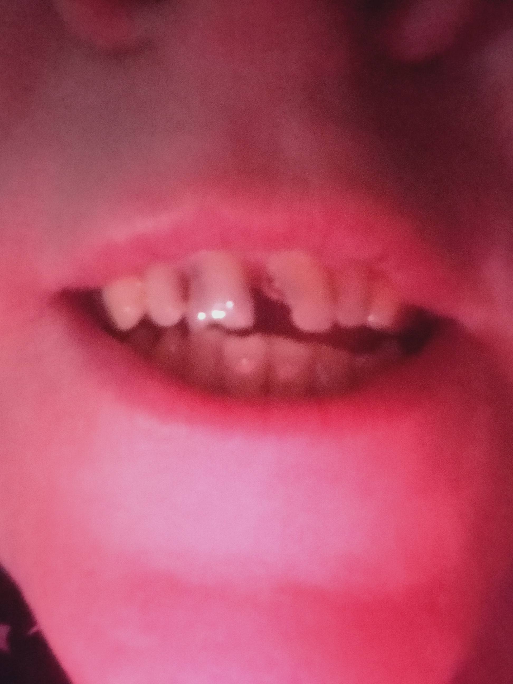 Прошу пожалуйста помощи кто сколько сможет,на зубы