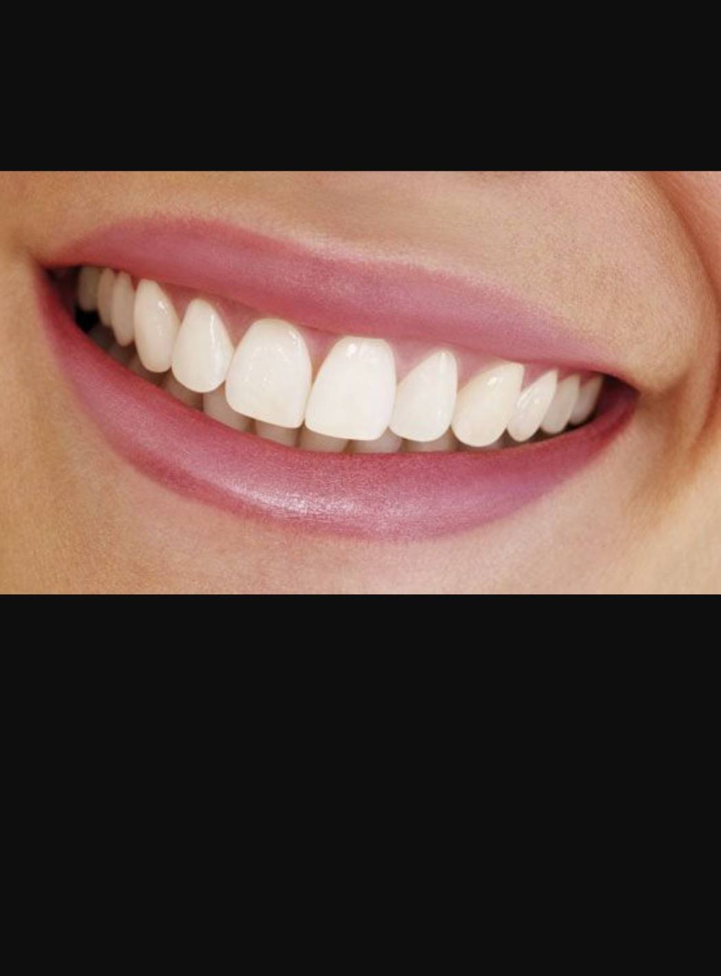 Больше всего мечтаю о красивой улыбки