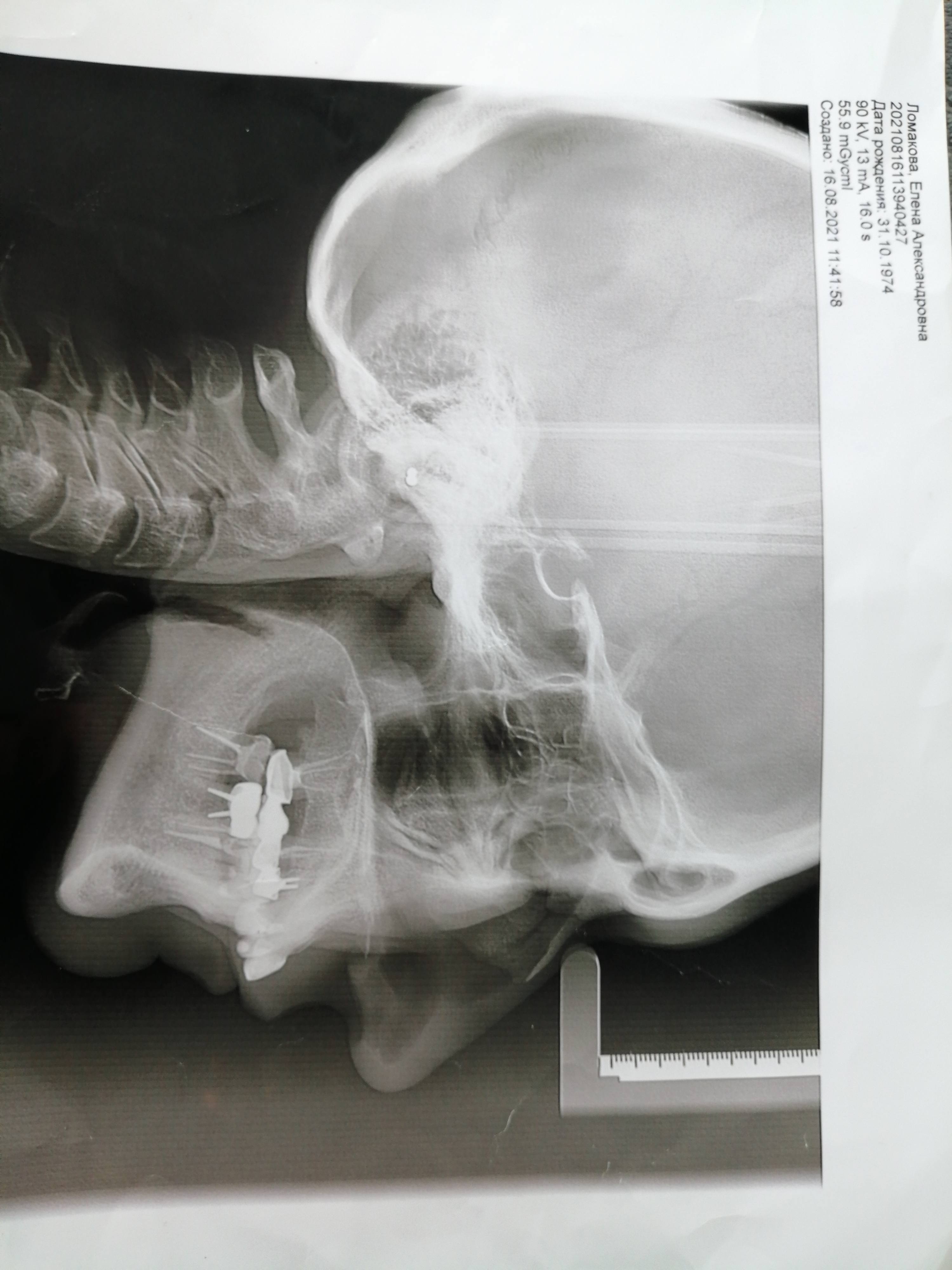 Я мечтаю о ортогнатической операции