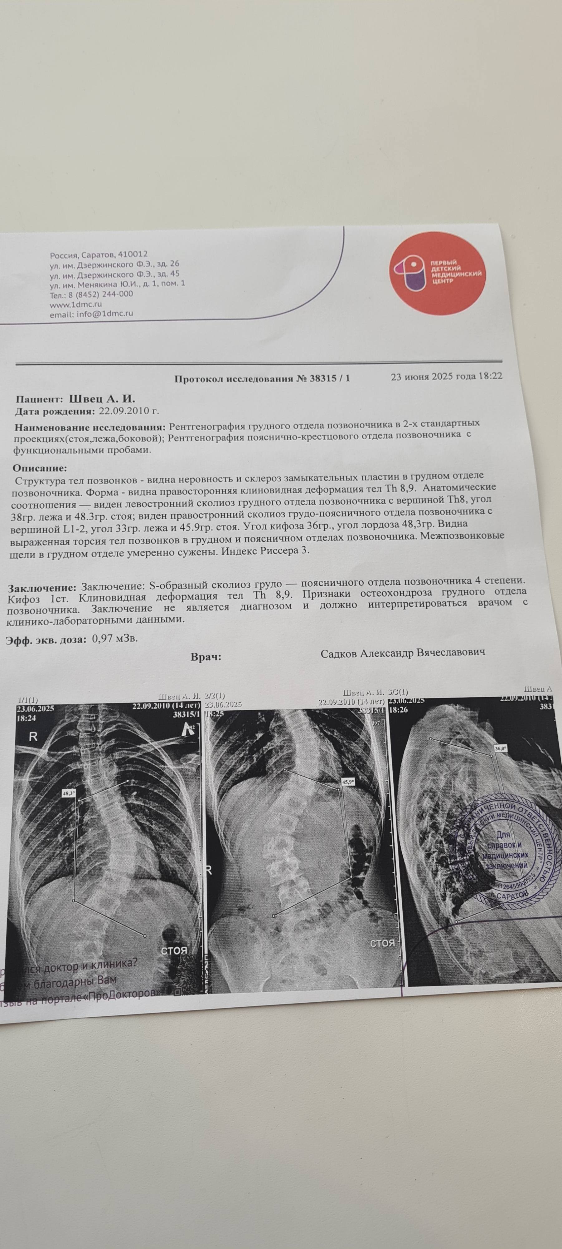 ПОМОГИТЕ ПОЖАЛУЙСТА  СКОЛИОЗ 3 СТЕПЕНЬ