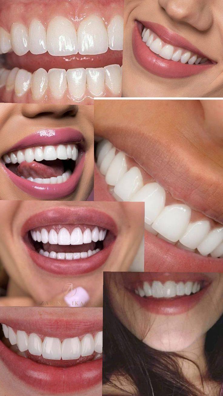 Мечтаю улыбаться