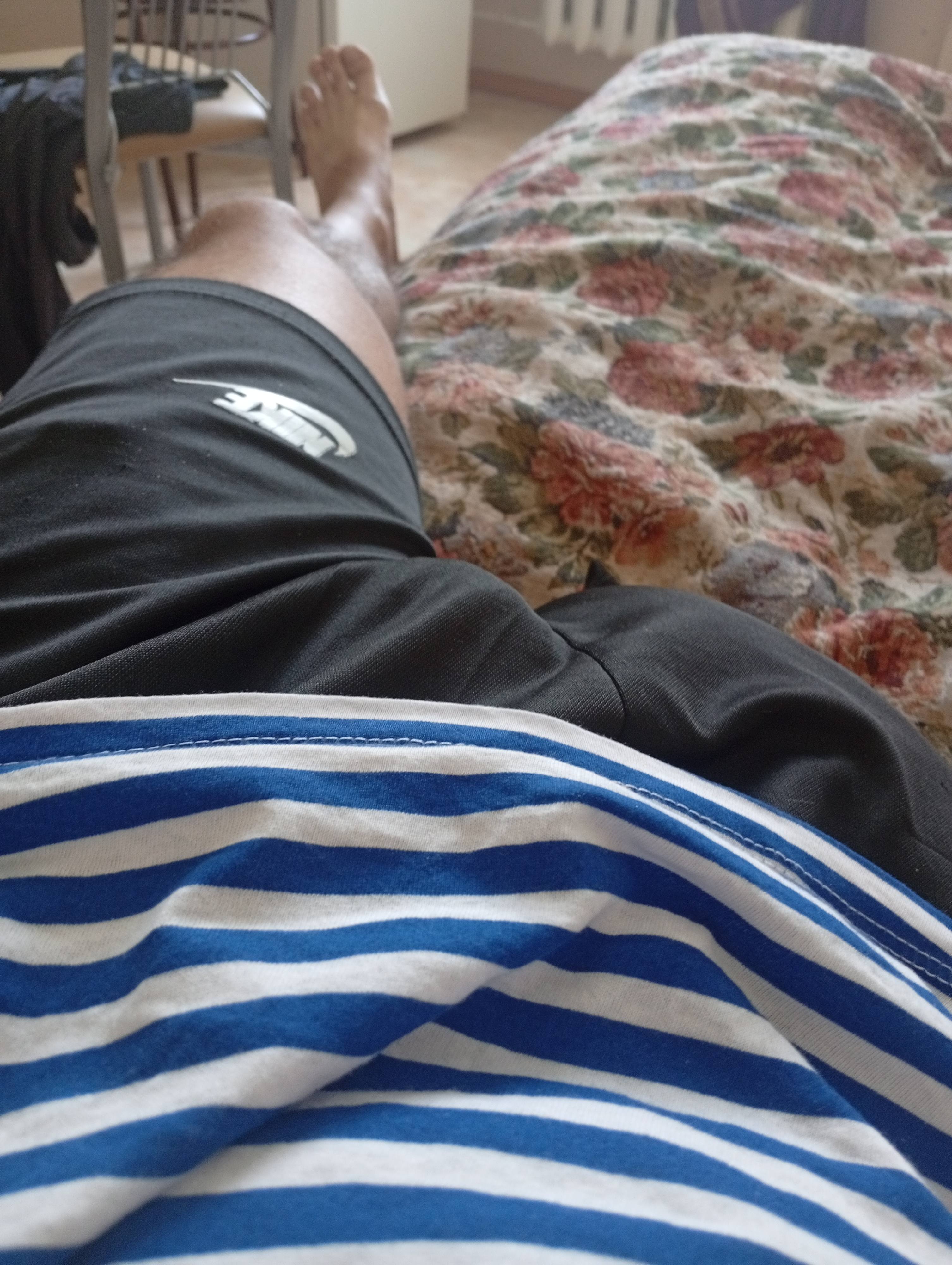 Мечтаю о бионическом протезе