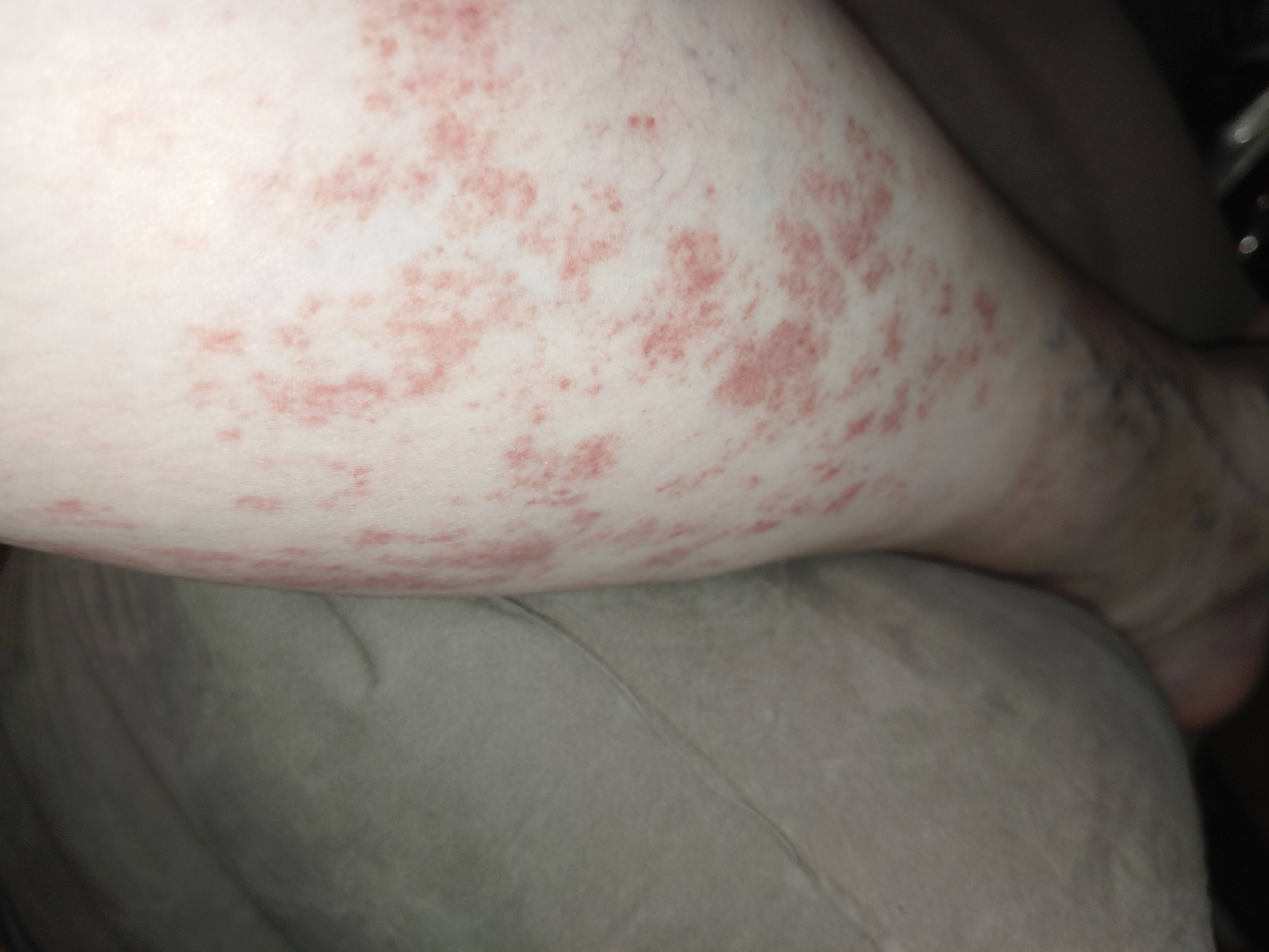 Срочно к дерматологу