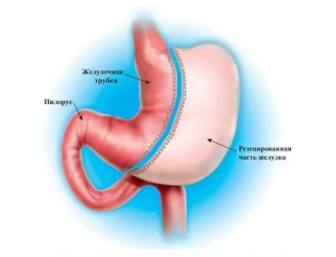 Нужна операция