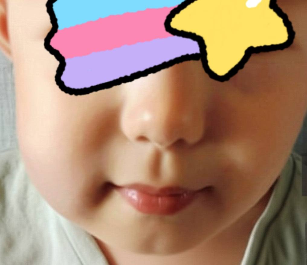 флюс опять, снова флюс у сына 🙏😭