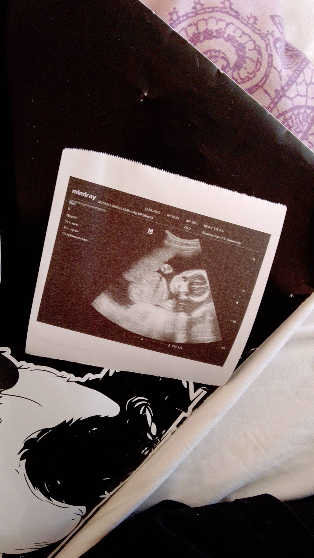 Помогите собрать немного для ребенка