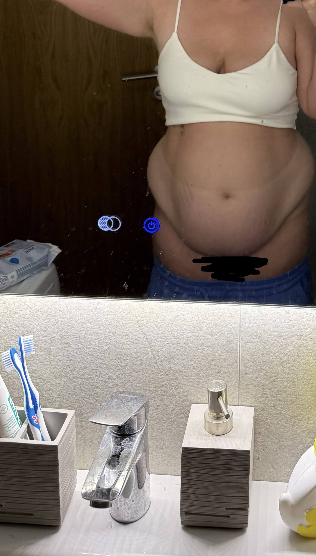 Помогите оплатить операцию после кесарево(абдомино