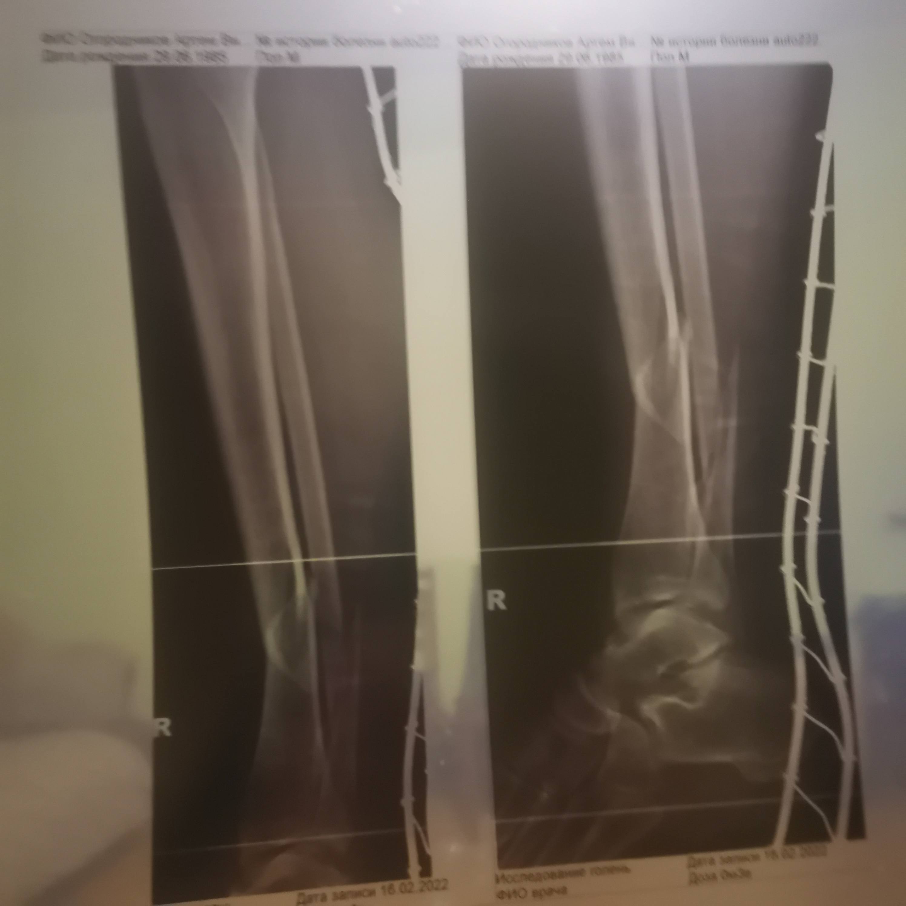 Реабелитация