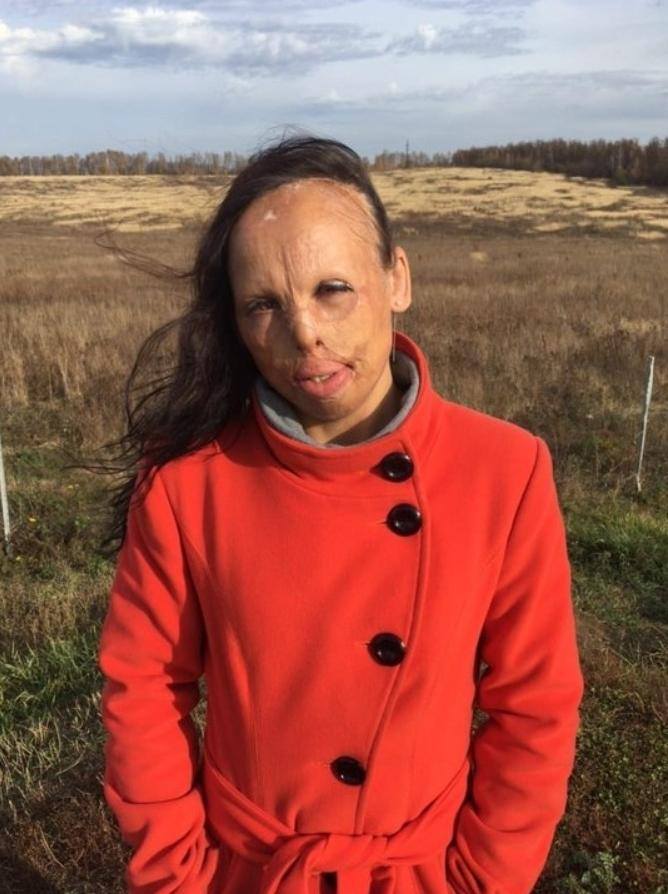 Выжить дальше