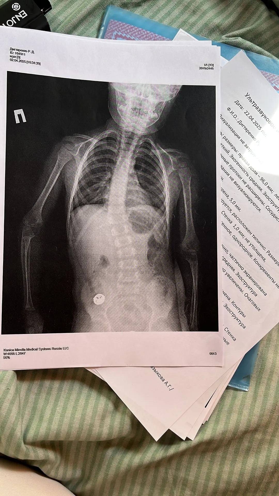 Нужна помощь собрать на операцию племянника 3.5 го