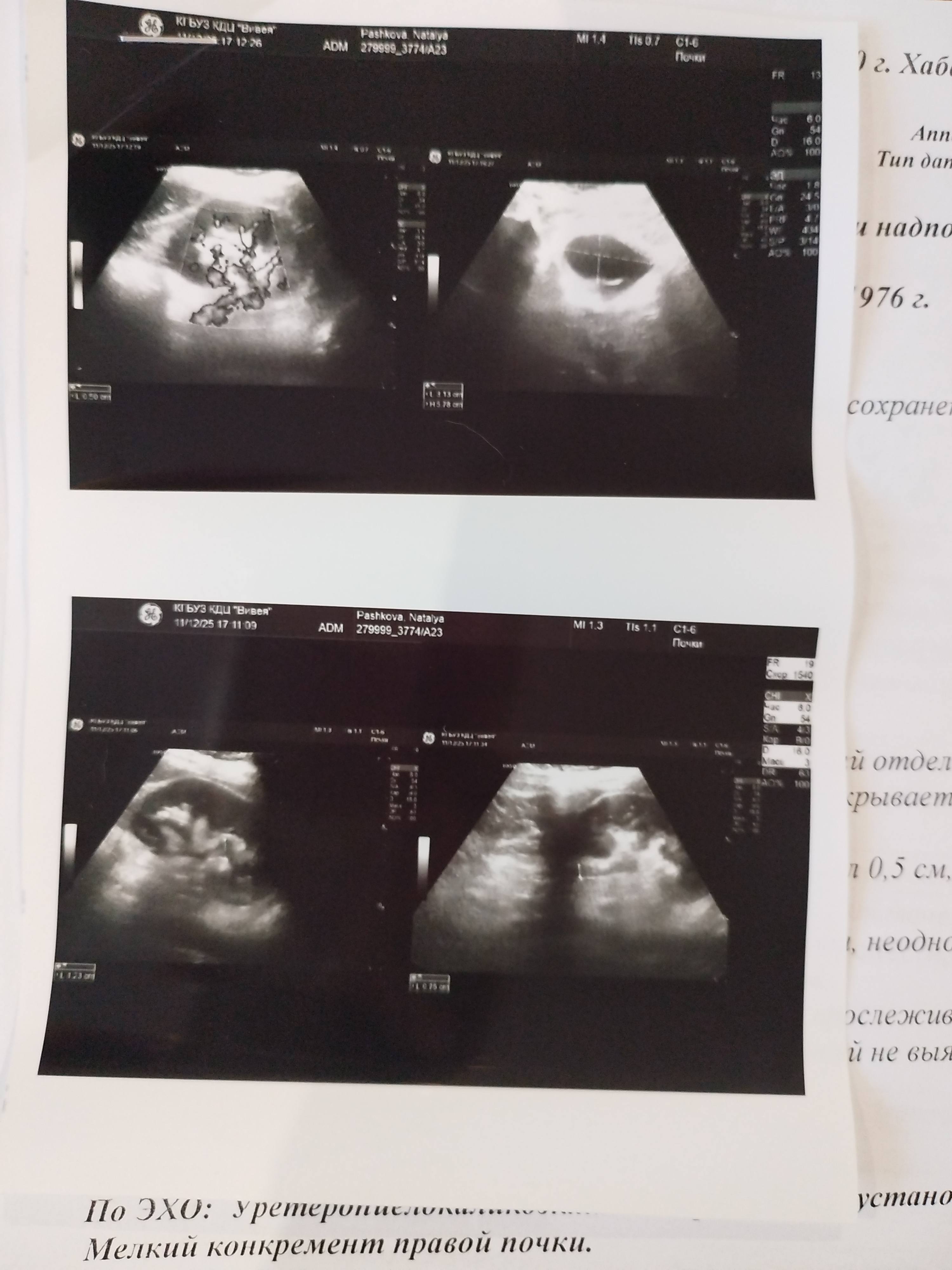 Нуждаюсь в денежной поддержке.