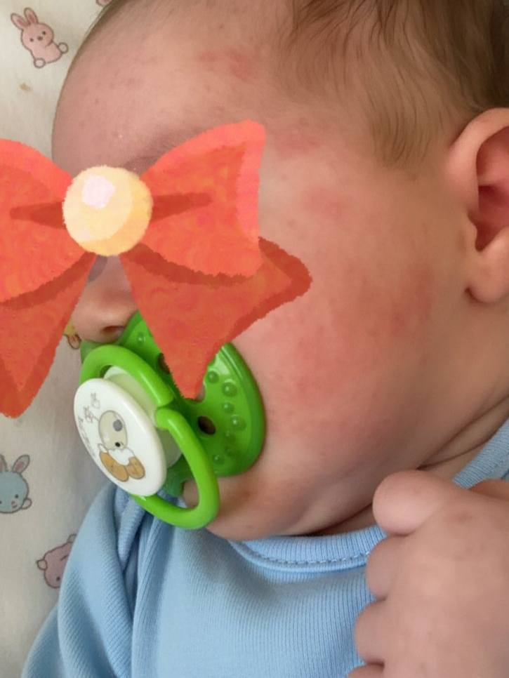 Я хочу идти работать, жду звонка 😔 аллергия хуже