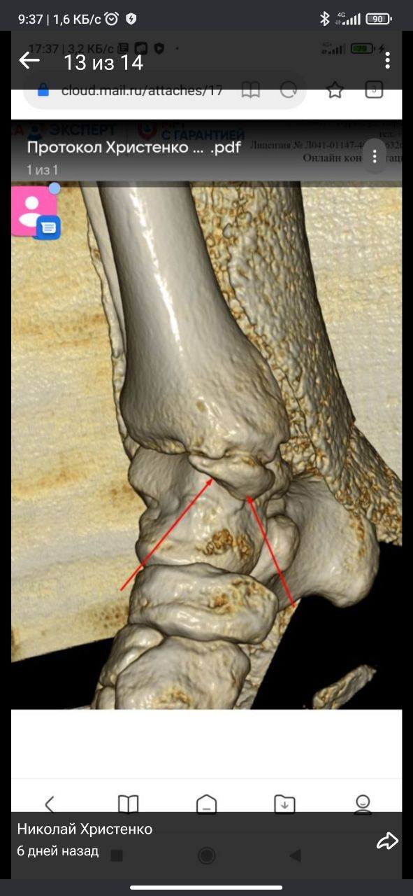 Участник СВО, на операцию