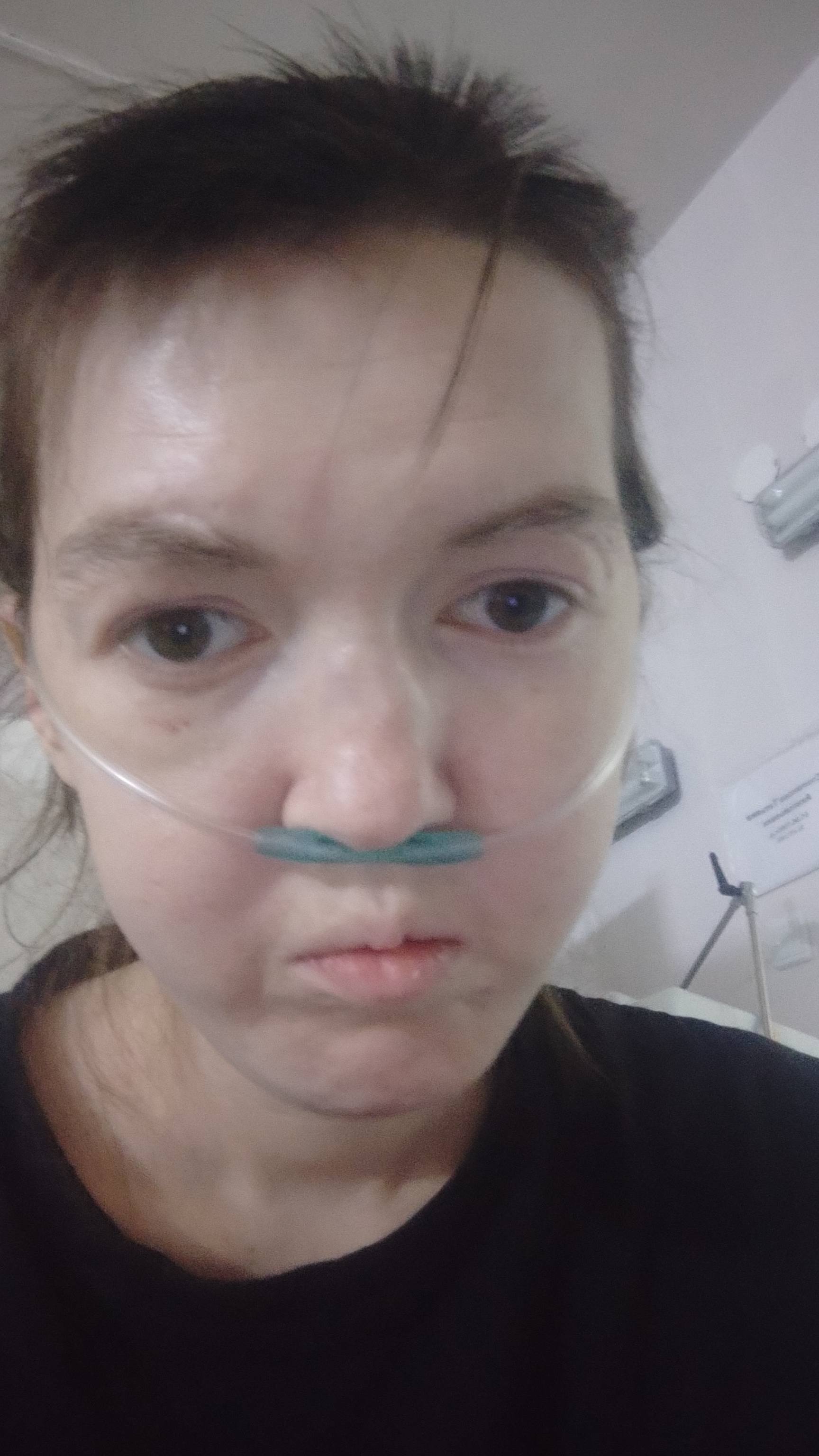 Помогите одолеть сложную форму туберкулёза!