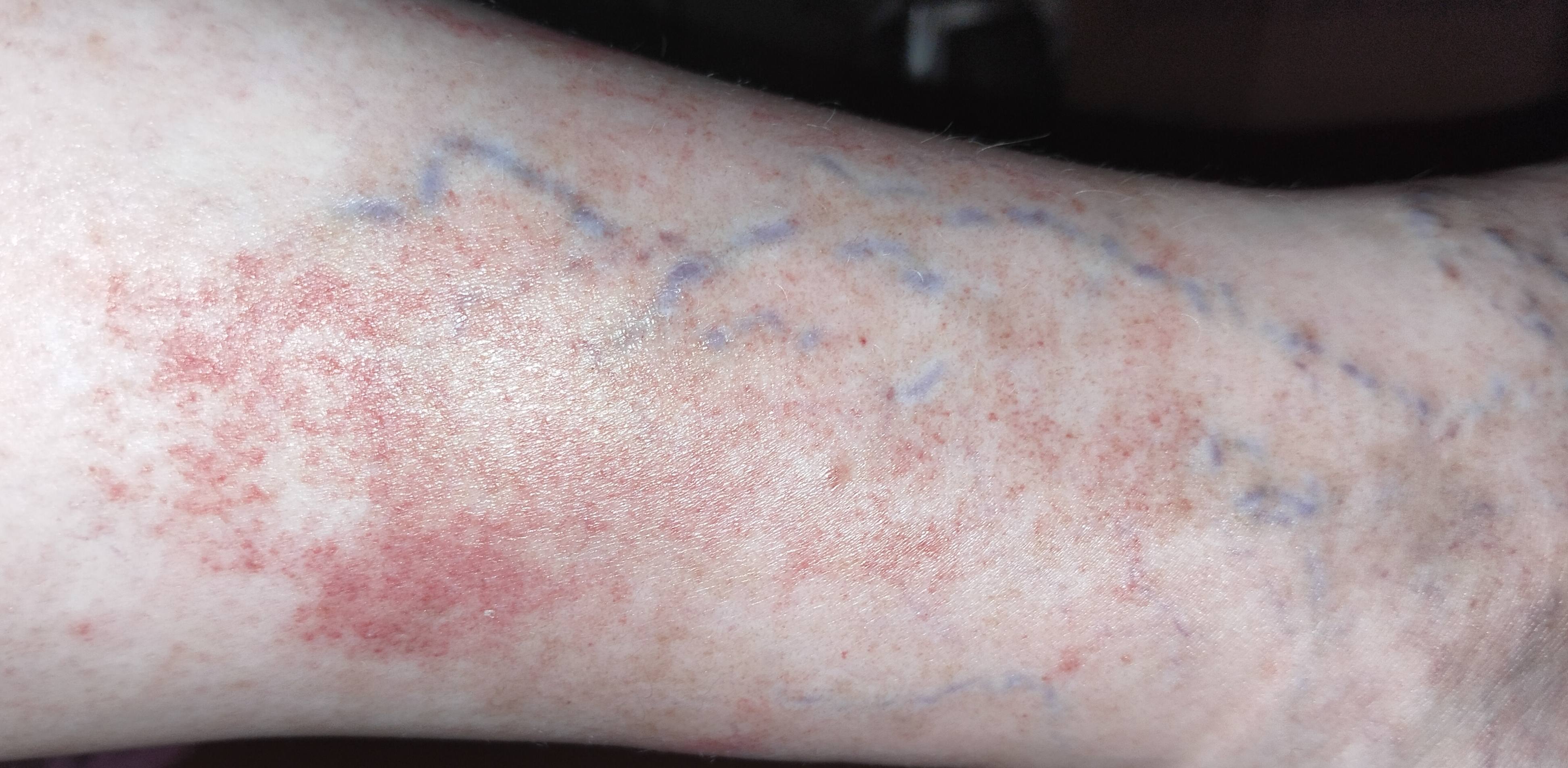 Через 3 дня можно пройти дешевле