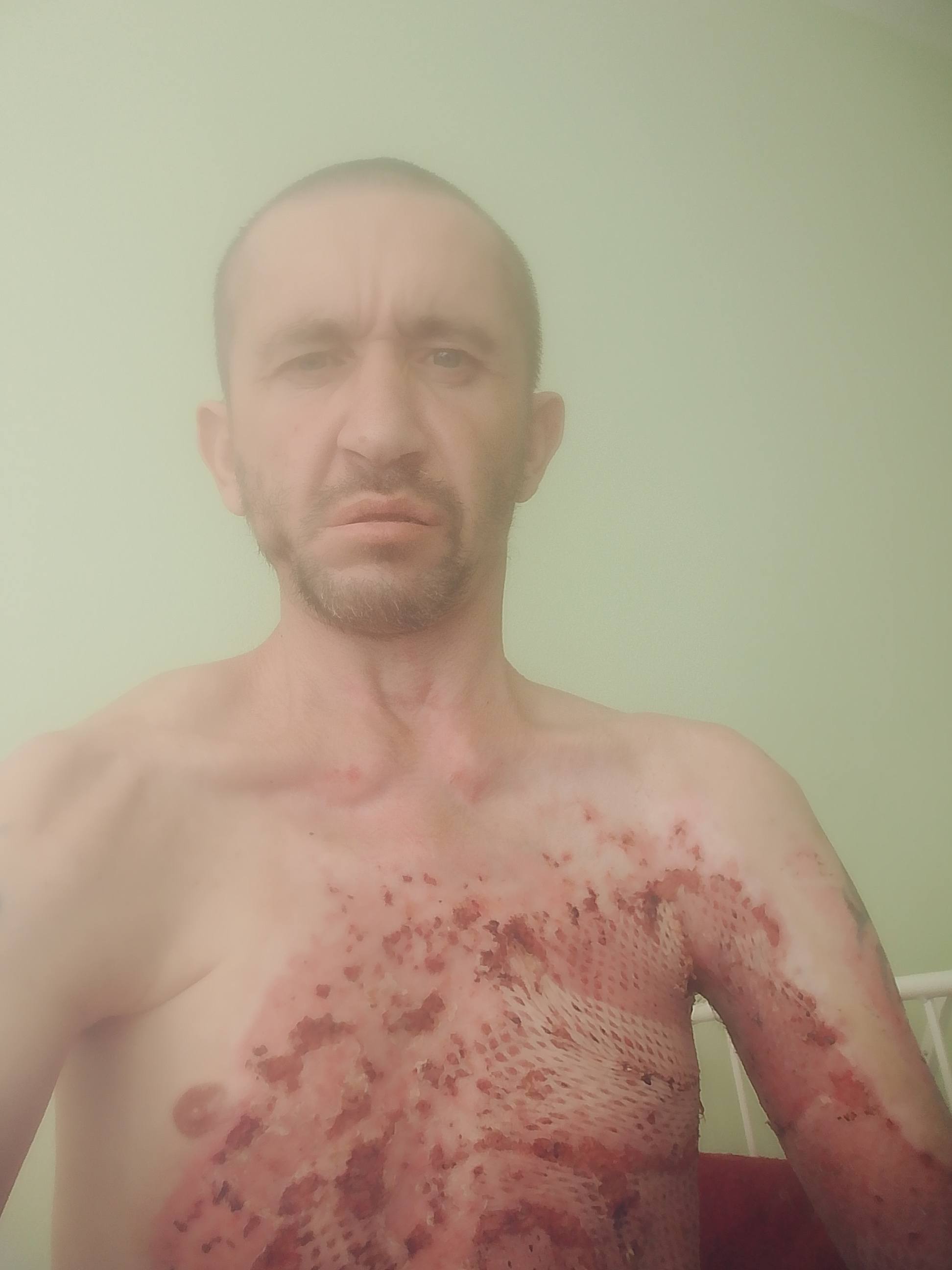 Помогите с лекарствами