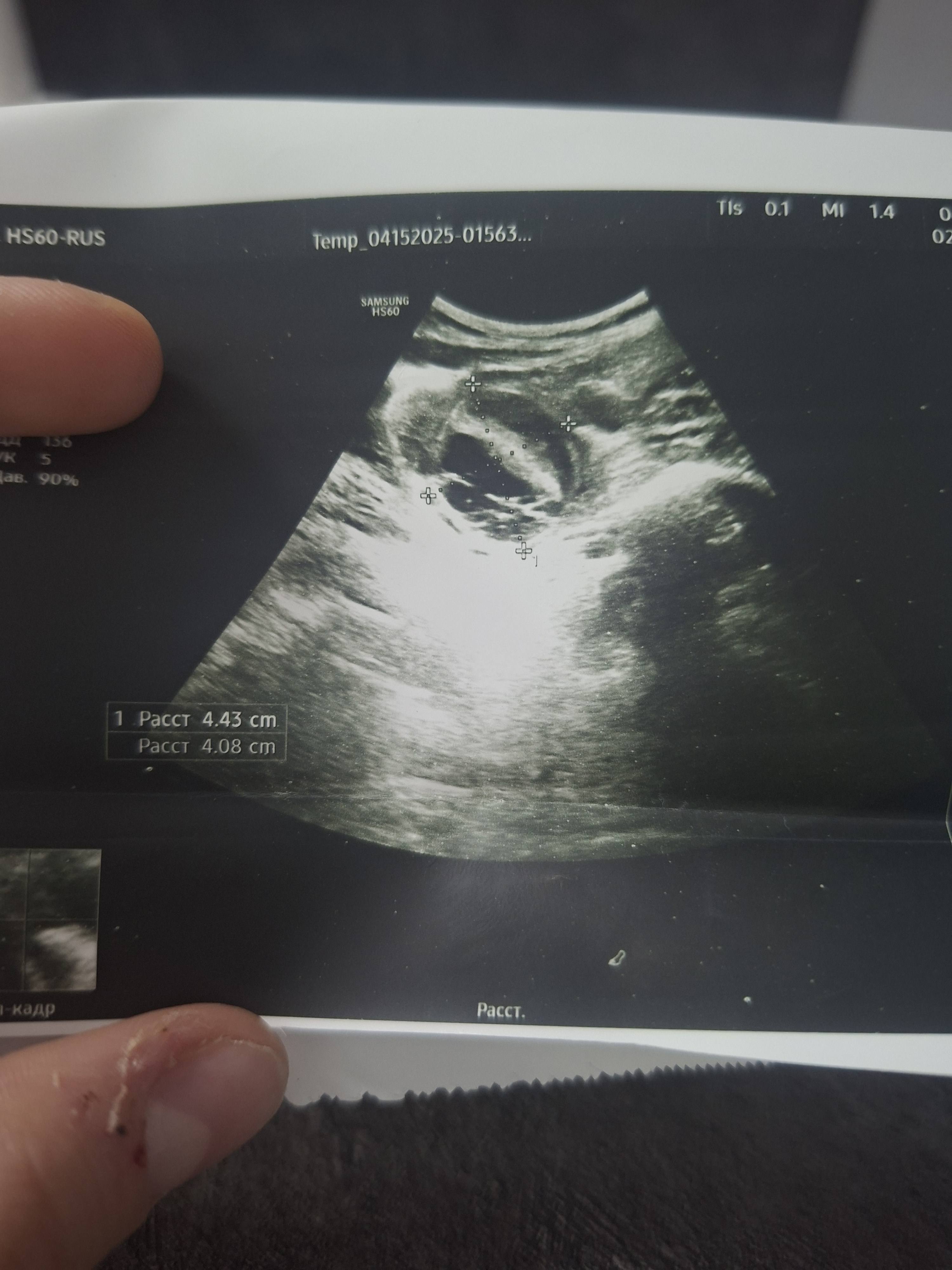 Помогите собрать на операцию