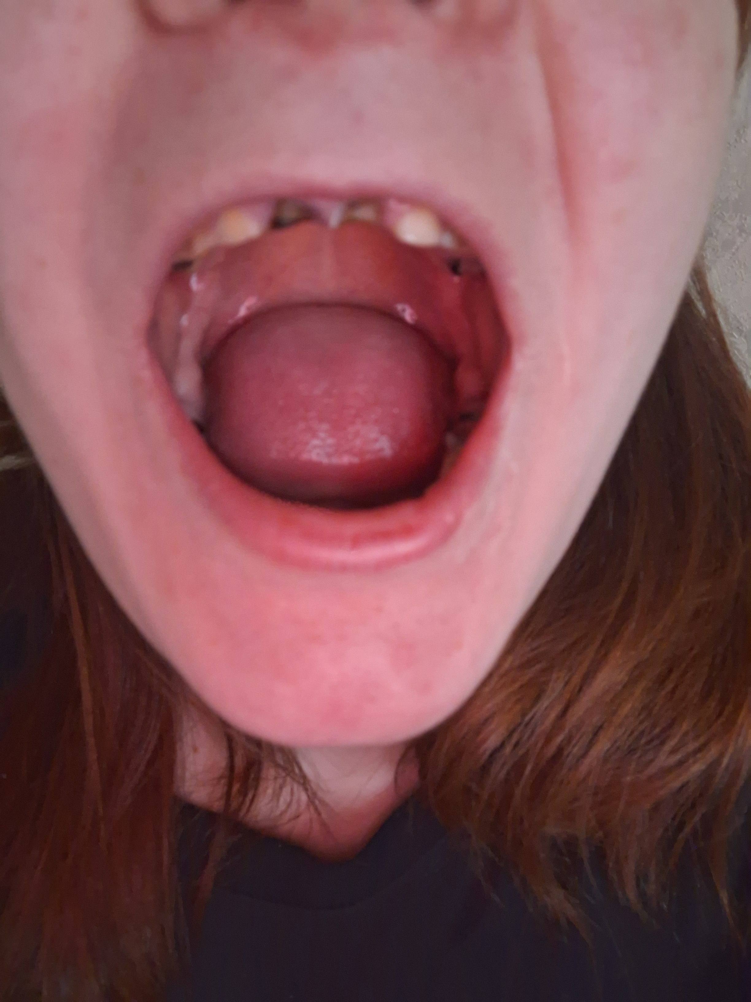 Помощь с зубами