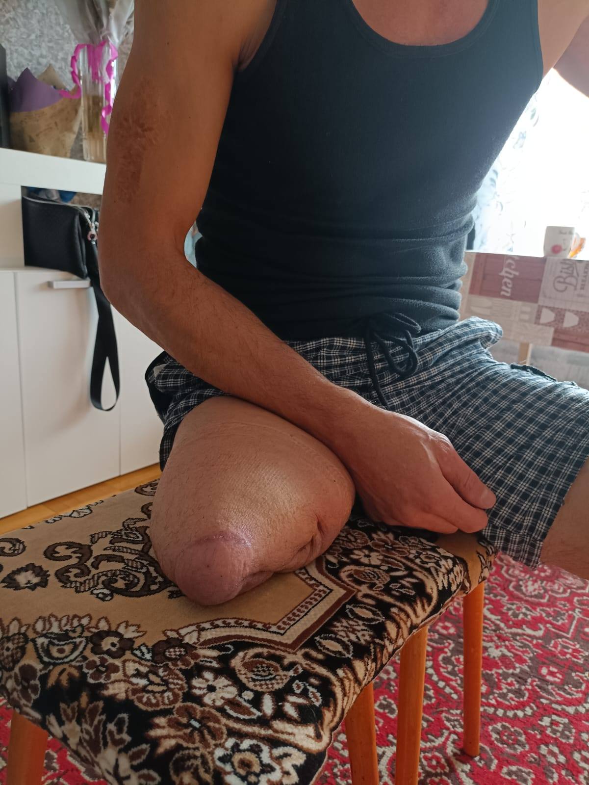 Прошу помочь с лечением