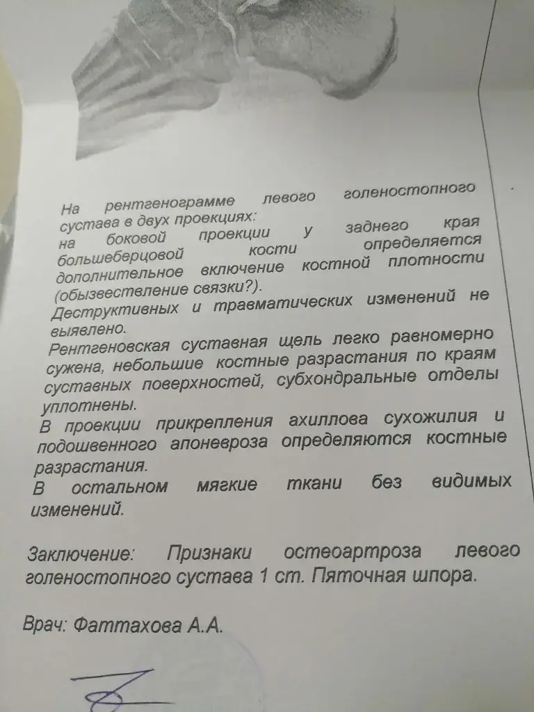 Лечение для моей маме с артрозом